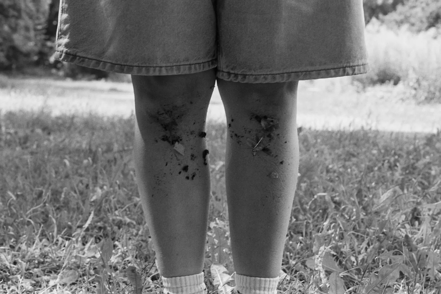 Die Aufnahme zeigt einen jungen Mann von der Hüfte aufwärts. Er trägt hellgraue Shorts und weiße Socken. Seine Beine sind mit dunklem Schlamm bedeckt, was darauf hindeutet, dass er sich im Freien aufgehalten hat. Der Hintergrund ist eine grasbewachsene Fläche mit einigen Bäumen.